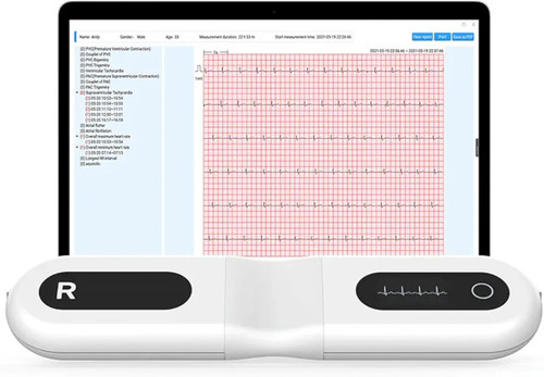 دستگاه نوار قلب Wellue | مانیتور ECG قابل حمل با بلوتوث، اپلیکیشن هوشمند و تحلیل ریتم قلب